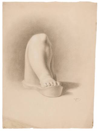 Study of Plaster Leg